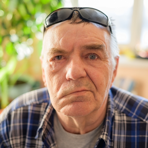 bells-palsy-Excelsior-Physiotherapy-Sherwood-Park-AB