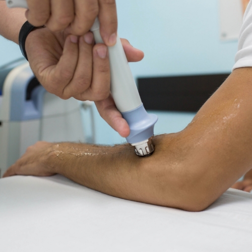 shockwave-piezowave-therapy-Excelsior-Physiotherapy-Sherwood-Park-AB